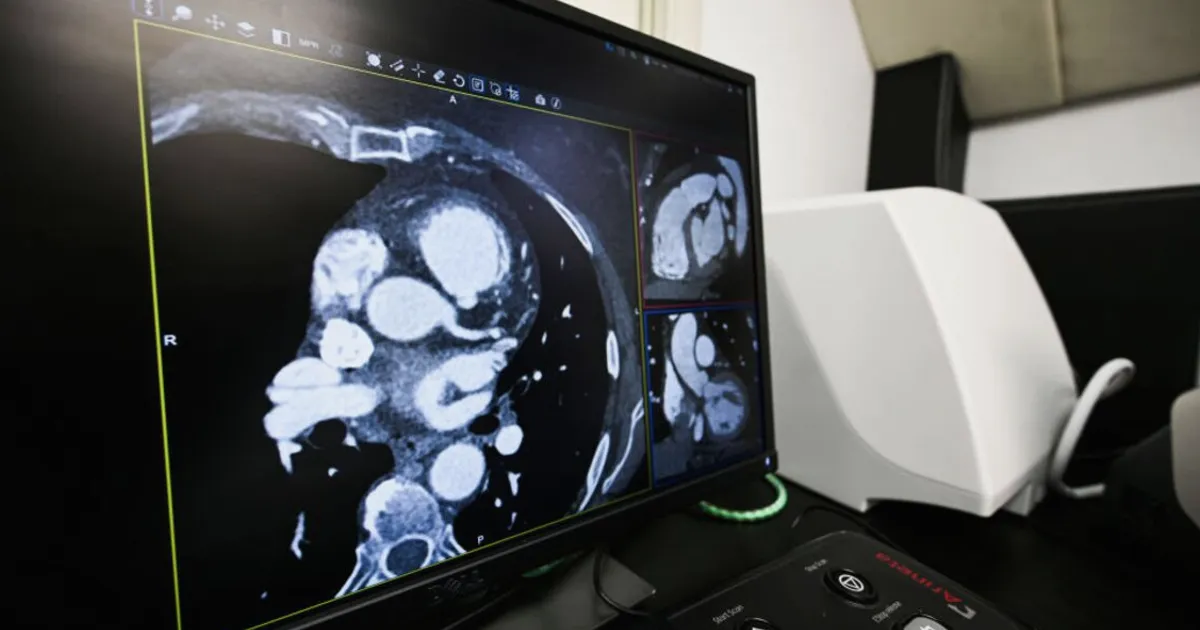 Heart Biotech Kardigan Targets $373M in US IPO for Late-Stage Drugs